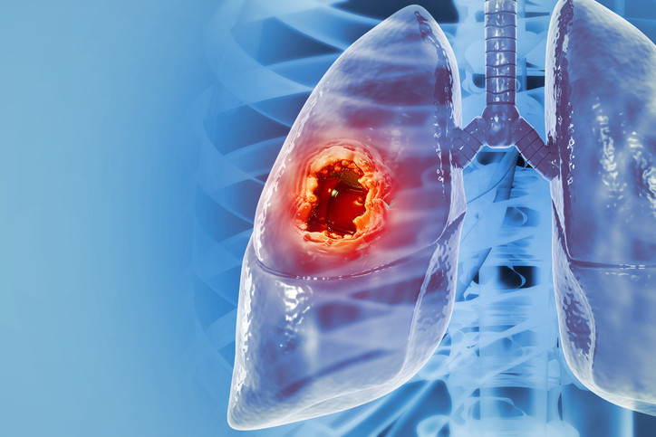 Her yıl 2 milyona yakın insan bu yüzden ölüyor! Risk faktörleri ve en yaygın belirtileri neler?