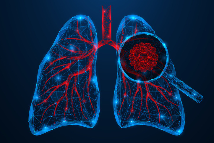 Her yıl 2 milyona yakın insan bu yüzden ölüyor Risk faktörleri ve en yaygın belirtileri neler