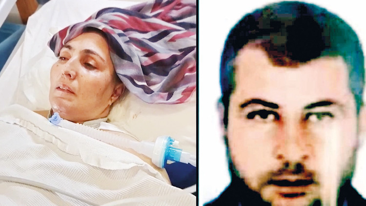 Halime’yi dövüp kaza süsü vermeye çalışmıştı: 55 gündür yaşam savaşı veriyor