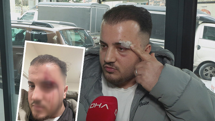 İstanbul'da akılalmaz olay: Dövdüğü adamı ATM'de tanımazlıktan geldi: Buyur kardeşim