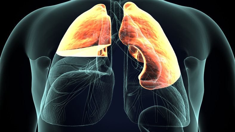 Hava kaçağı ameliyatla kapatılıyor