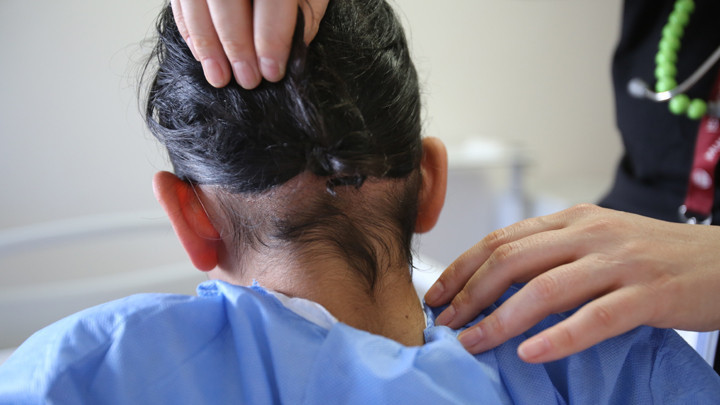 Hatay'da 14 yaşındaki çocuğun karnından 3 kilogramlık saç yumağı çıktı