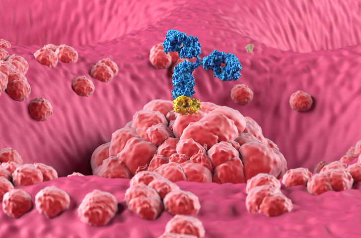 Senelerce ağrı çekti, bütün testleri ise temizdi... Hazımsızlık sanıyordu ama midesinde bambaşka bir şey çıktı
