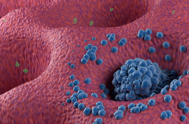 Senelerce ağrı çekti, bütün testleri ise temizdi... Hazımsızlık sanıyordu ama midesinde bambaşka bir şey çıktı