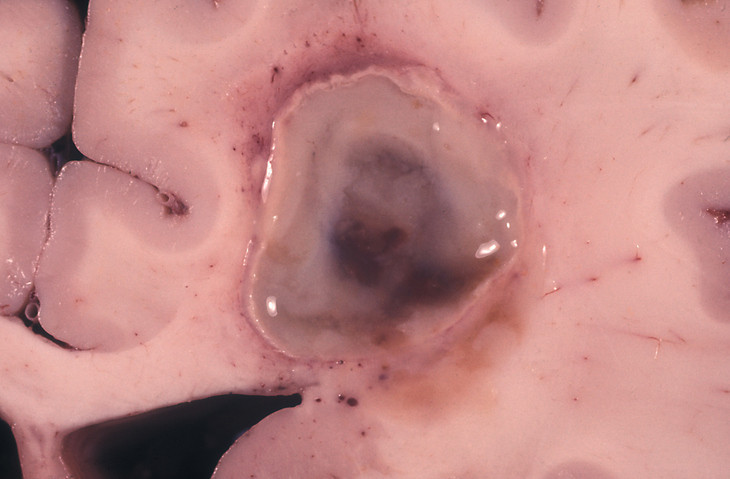 Çay yaparken fark etti… Günler sonra öğrendiği şey hayatını değiştirdi Çay yaparken fark etti… Günler sonra öğrendiği şey hayatını değiştirdi