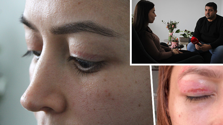 Güzellik salonundaki 1.100 TL'lik işlem genç kadının kabusu oldu: Şikayeti reddedildi | 'Çevremdekiler fark etti'