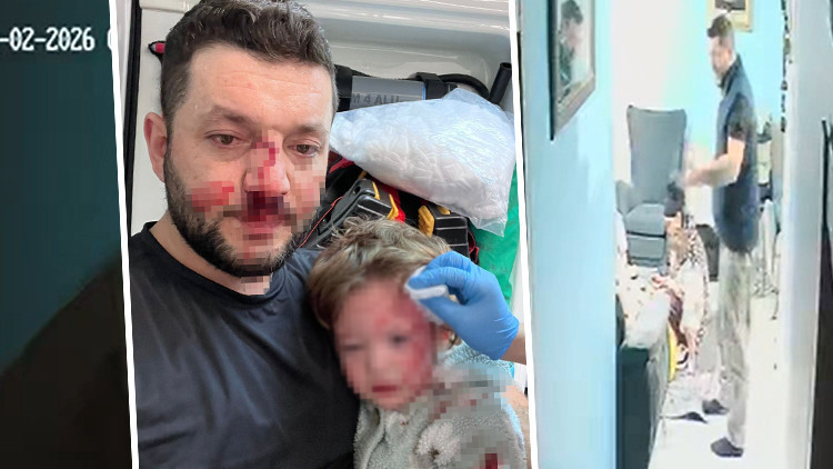 14 aylık bebek ve babası komşuları tarafından darbedilmişti: Güvenlik kamerası görüntüleri ortaya çıktı