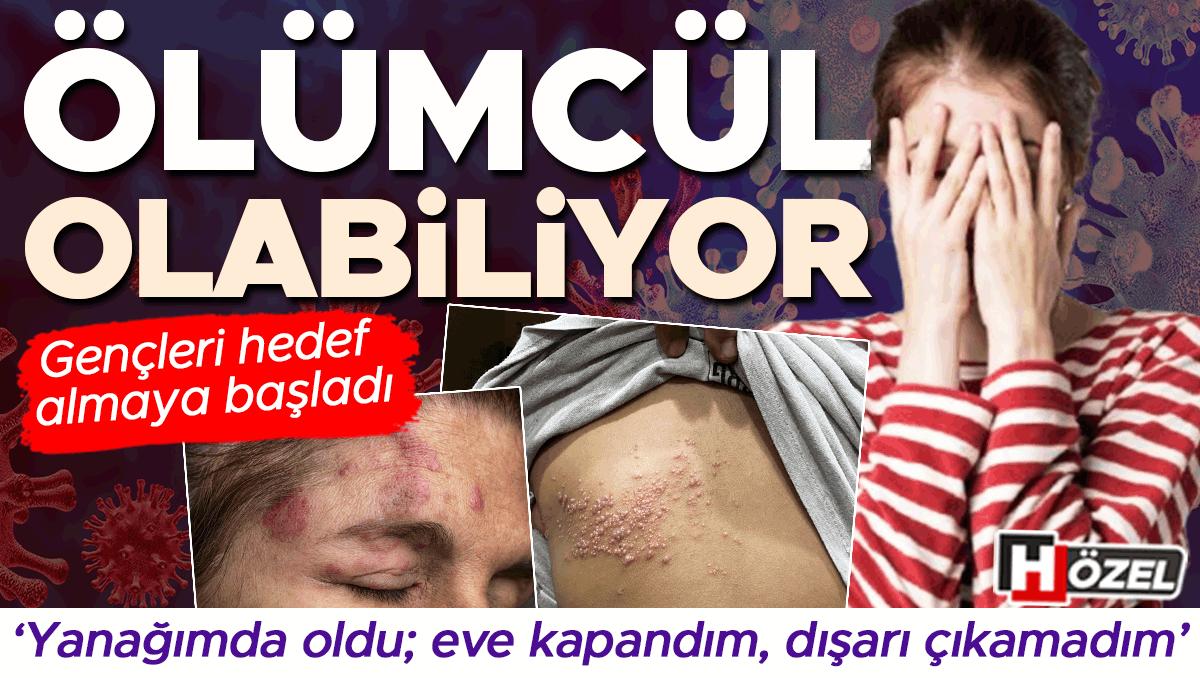 Gençleri hedef alıyor: Ölümcül olabiliyor! ‘Derime kaynar su dökülmüş gibiydi’, ‘Eve kapandım, dışarı çıkamadım’