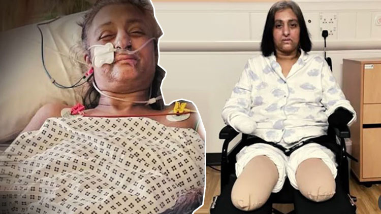 Köpeği yarasını yaladı, elleri ve ayaklarını kaybetti! Uzman isim uyardı: Tükürük teması ve ısırıkları sakın görmezden gelmeyin