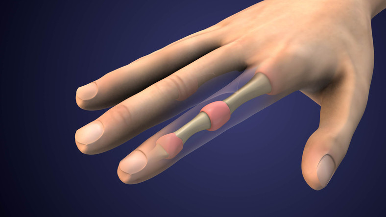 TEK TEHLİKE SEPSİS DEĞİL