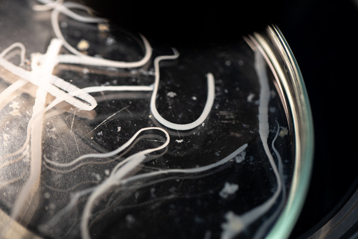 İLK KEZ İNSANDA GÖRÜLDÜ