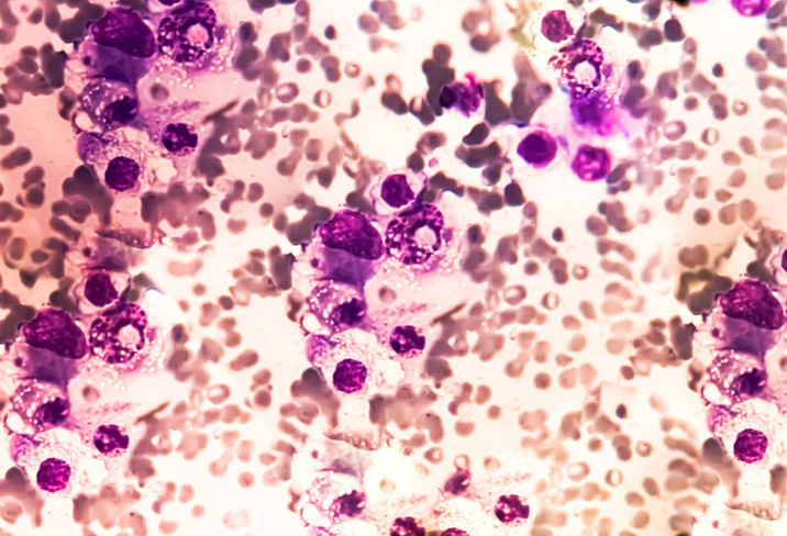 TEDAVİ SÜRECİ NASIL İŞLER