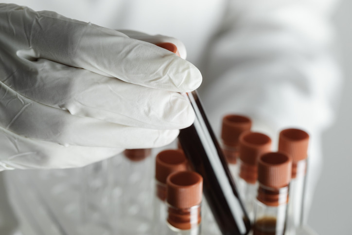 ‘Gençlik’ bu proteinlerde saklı olabilir... 100 yaşına ulaşmanın sırrı kanımızda mı?