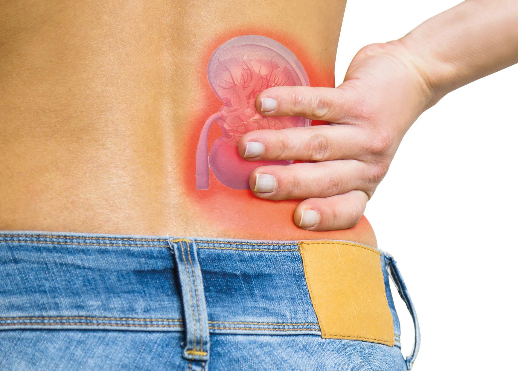 TBV’den dev böbrek maketli kampanya... Türkiye’de 72 bin diyaliz hastası var