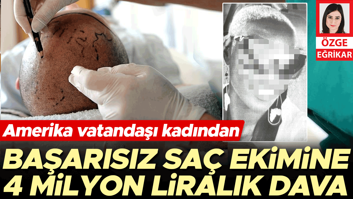 Başarısız saç ekimine 4 milyon liralık dava