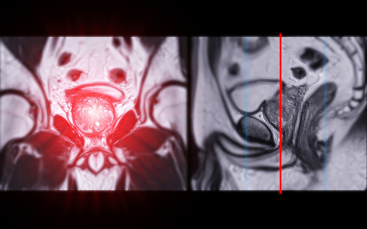 Dünyada iki kişiden biri bu hastalığa yakalanıyor Çoğu insan bu sinsi belirtileri gözden kaçırıyor