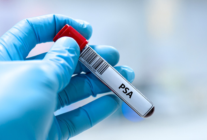 Dünyada iki kişiden biri bu hastalığa yakalanıyor Çoğu insan bu sinsi belirtileri gözden kaçırıyor