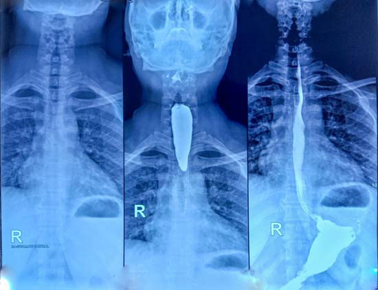 ‘TEMİZ’ RAPORU VE BÜYÜK MÜCADELE