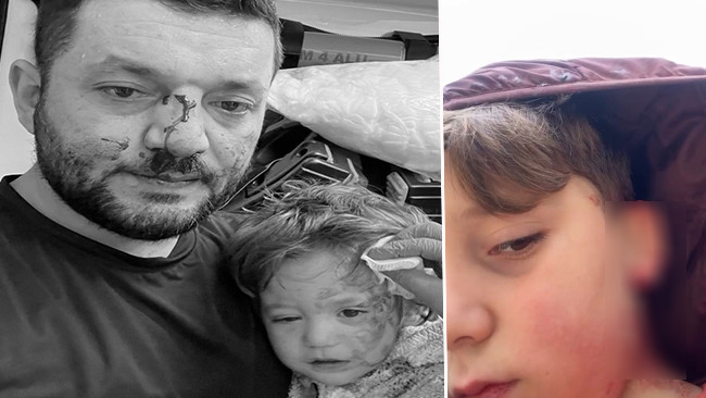 Kucağında 14 aylık bebeğiyle darbedilmişti: Bu kez de oğlu yaralandı! 'Tehditler alıyoruz, evimi satışa çıkardım'
