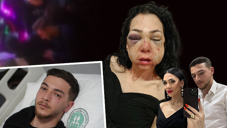 Bir uyarı yüzünden vahşet! Anneye feci dayak... 'Oğlumun gözü önünde bana bunu yaptılar'