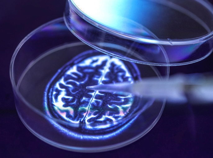 Alzheimer sonunda tarih mi oluyor? Hafıza sorunları başlamadan önce sinyal verebilen test geliştirildi