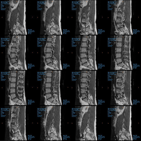  Ünlü isim hayatını kaybetti Hala gizli tehlike olmayı sürdürüyor