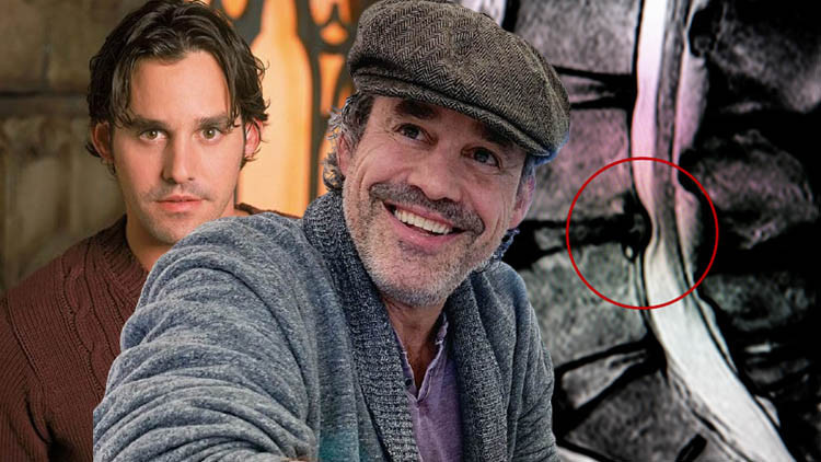 Bu belirtilere dikkat: Ünlü isim hayatını kaybetti! Hala gizli tehlike olmayı sürdürüyor