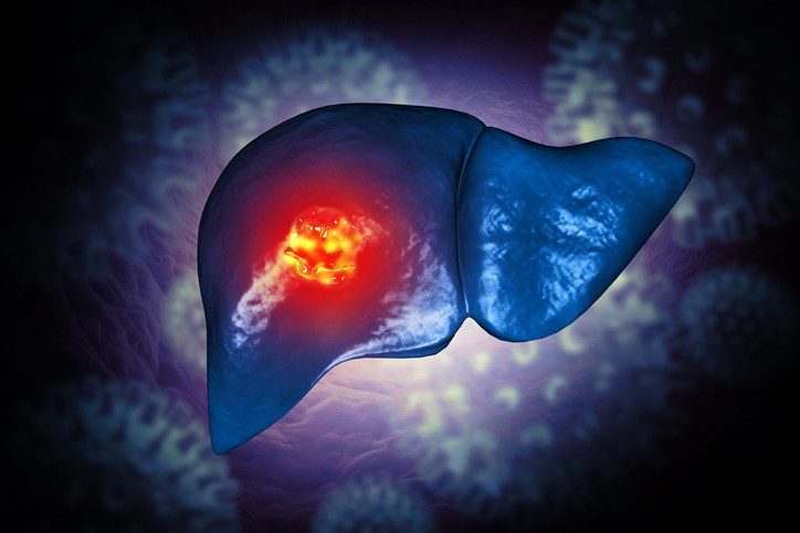  Kanserde görünmeyen tehlikeler