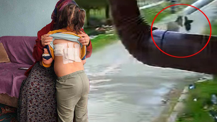 4 yaşındaki küçük kız eşeğin saldırısına uğradı! O anlar kamerada