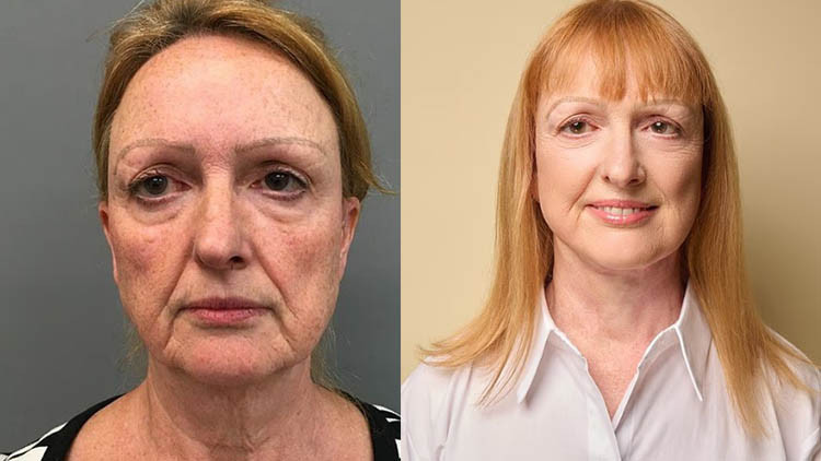 Yaşını söylediğinde herkes şaşırıyor: Bu yöntemle her şey değişti