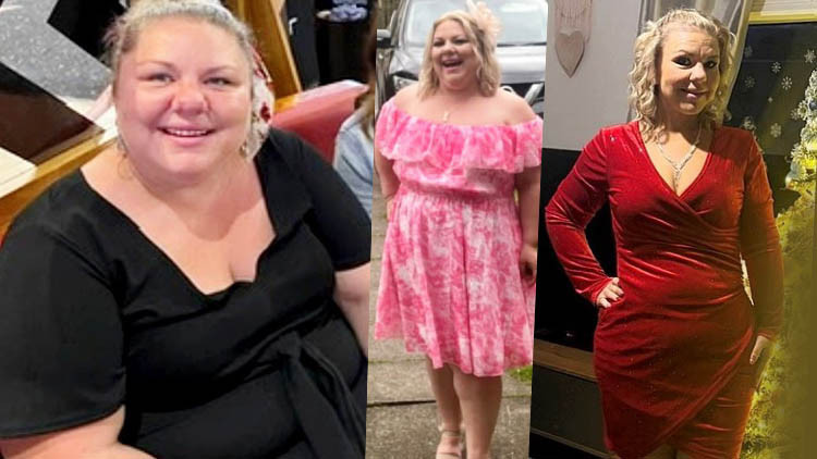 Zayıflama ameliyatı gerçeği: Tam 57 kilo verdi ama yaşadıkları şaşırttı… ‘Kimse bu detayları anlatmıyor’