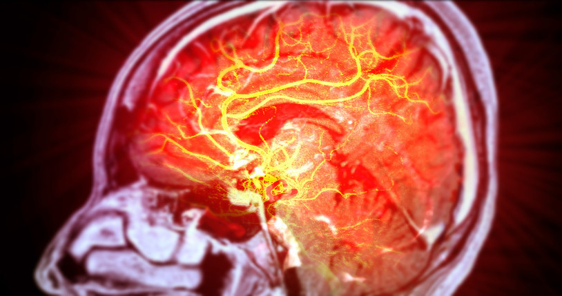 Migren dediler, birkaç hafta ömrü kaldığı ortaya çıktı Genç kız şimdi yaşam savaşı veriyor