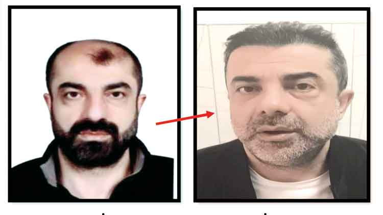 Azmettirici ameliyatla yüzünü değiştirmiş