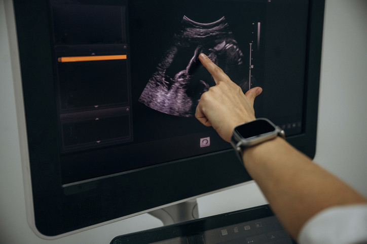 Hamilelikte ağrı kesici kullanımı otizme neden olur mu