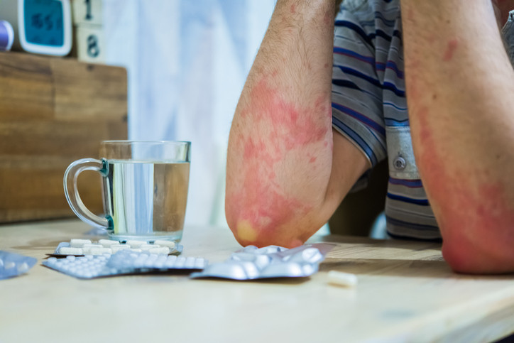  Yüzü tanınmaz hale geldi, 66 gün hastanede kaldı