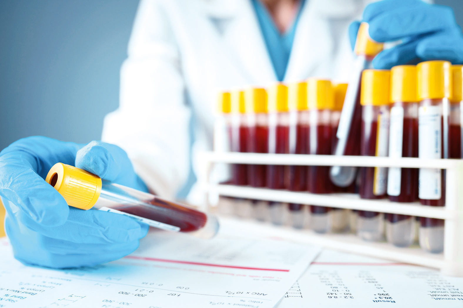 Alzheimer’da kan testi umudu