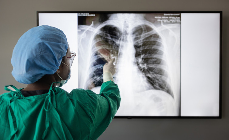 Nefes darlığı şikâyeti vardı, doktorlar gördüklerine inanamadı: Akciğerlerden ‘ağaç dalları’ çıktı
