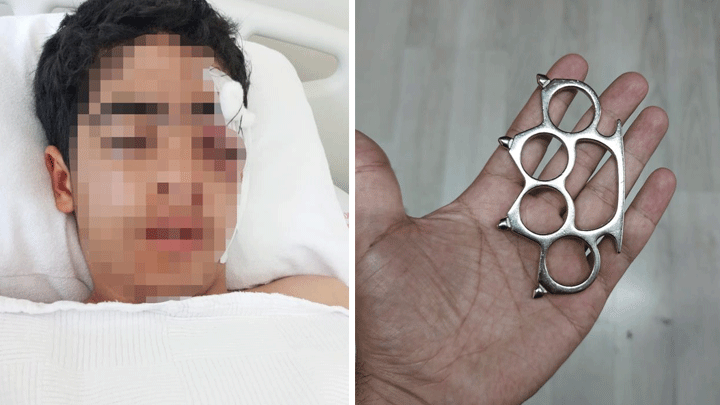 Esenyurt'ta dehşet! 15 yaşındaki çocuk 'Bana şaka yapma' dediği arkadaşı tarafından muştayla öldüresiye dövüldü