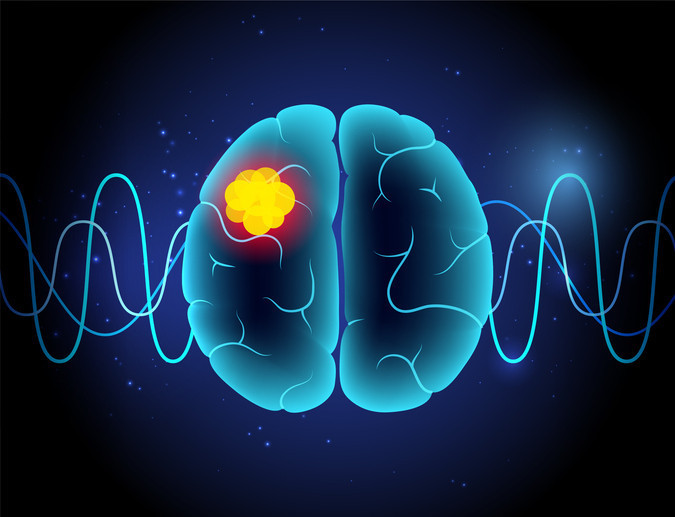 Baş ağrısı ve unutkanlığı hafife almayın Altından bir tümör çıkabilir