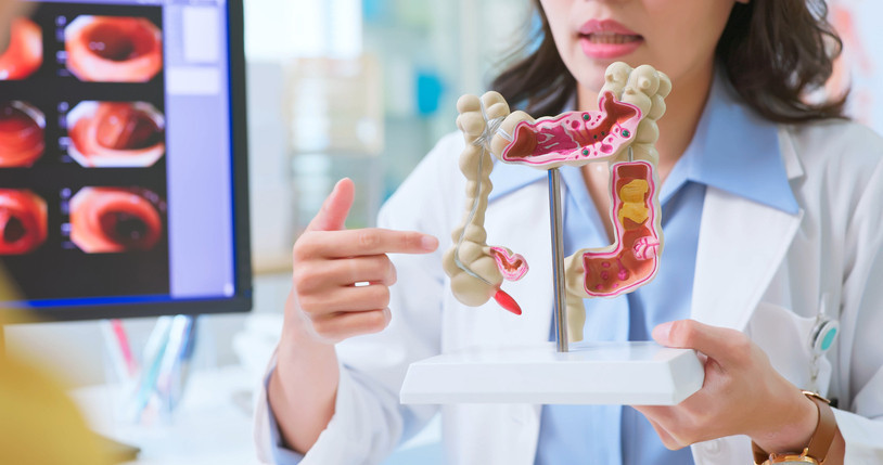 Tuvalette bu alışkanlığı sakın atlamayın: Doktordan kolon kanseri uyarısı Tuvalette bu alışkanlığı sakın atlamayın: Doktordan kolon kanseri uyarısı