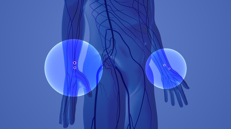 El uyuşması deyip geçmeyin Kalıcı hasara neden olabilir