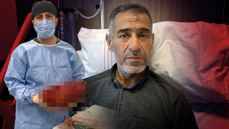 Ağrı şikayeti ile gitti, varılan teşhis doktorları da hayrete düşürdü | Normalde yarım kilo olması gerekirken 8 kiloya ulaşmıştı