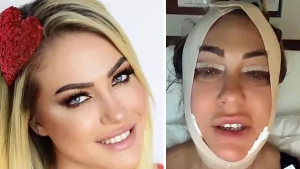 Ünlü türkücü değişimi ile şaşırttı Sosyal medya ikiye bölündü... Ünlü türkücü değişimi ile şaşırttı Sosyal medya ikiye bölündü...