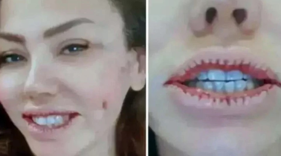 Ünlü türkücü değişimi ile şaşırttı Sosyal medya ikiye bölündü... Ünlü türkücü değişimi ile şaşırttı Sosyal medya ikiye bölündü...