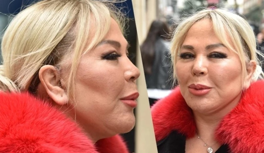 Ünlü türkücü değişimi ile şaşırttı Sosyal medya ikiye bölündü... Ünlü türkücü değişimi ile şaşırttı Sosyal medya ikiye bölündü...
