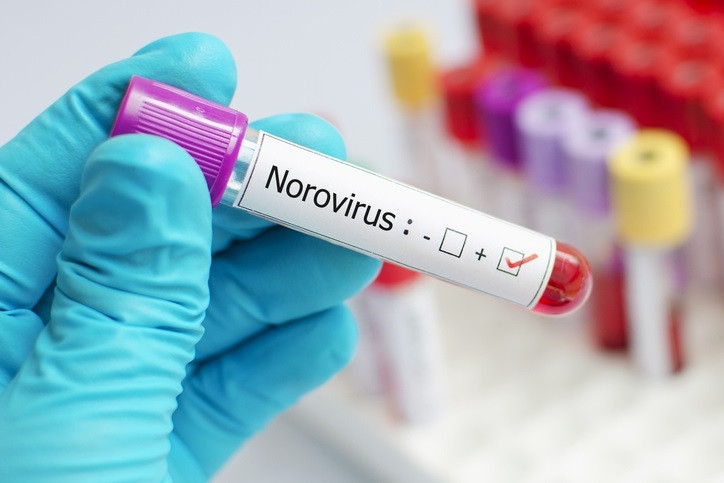 Norovirüs Nedir