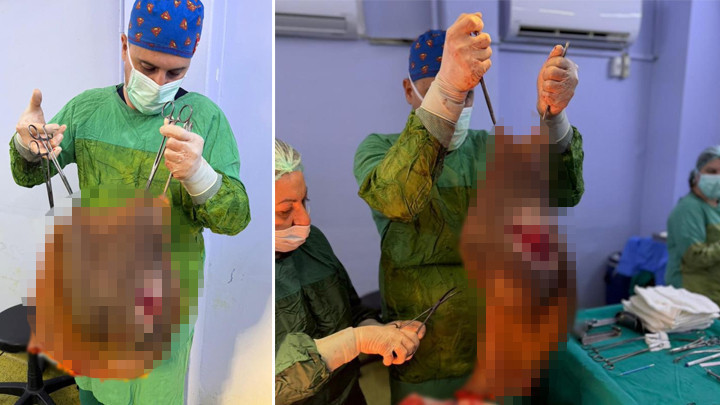 Aydın’da 67 Yaşındaki Kadının Karnından 40 Kilogram Kitle Çıkarıldı