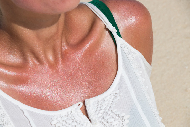 Güneşsiz bronzlaşma gerçekten güvenli mi Uzmanlar otobronzan ürünlerdeki riski anlattı Güneşsiz bronzlaşma gerçekten güvenli mi Uzmanlar otobronzan ürünlerdeki riski anlattı