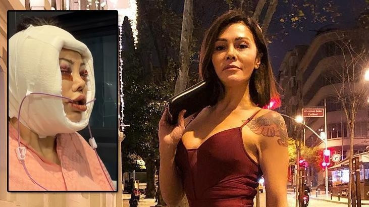 DİDEM CERAN NEDEN YÜZ NAKLİ OLDU