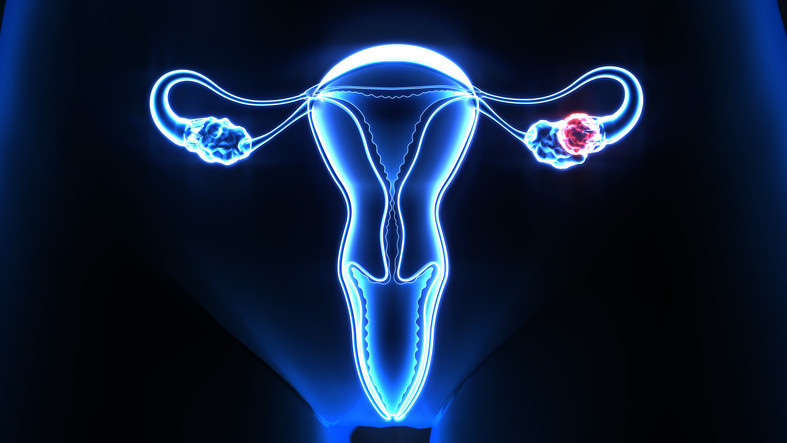 190 milyon kadını etkiliyor: Tükürük testi endometriozis tanısında yılları kısaltabilir